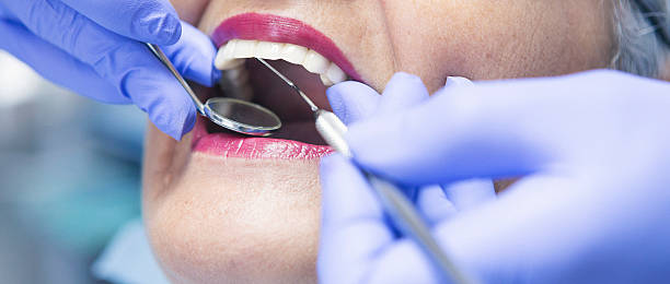 Best Emergency Dental Care for Broken or Chipped Teeth in Lindsay, OK